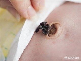 婴儿肚脐自然掉后是否要擦碘伏？