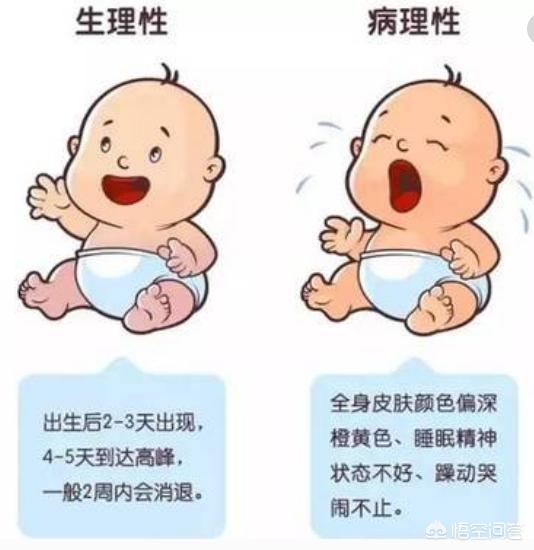 宝宝黄胆严重会对宝宝产生什么影响呢？