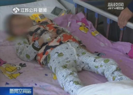 5岁男童走路经常摔跤 一查是得了这种病