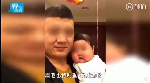 婴儿患上高血糖、肾结石！竟是被这种「常用药」害了，现在知道还不晚