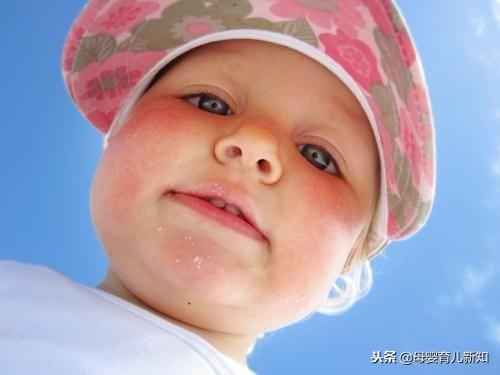 宝宝脸上出现“红苹果”怎么办？这4个原因及对策要清楚