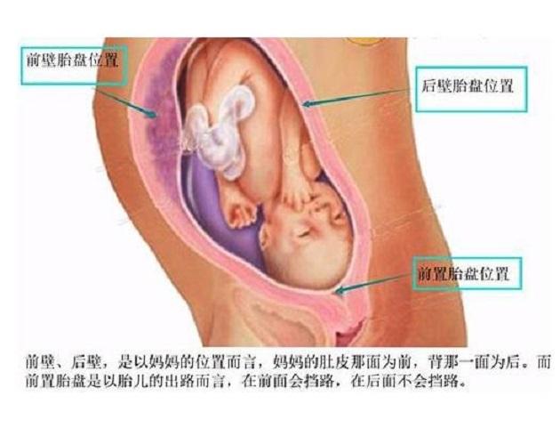 产检单上此数据，关乎胎宝安危，出现这种情况，流产、早产风险高