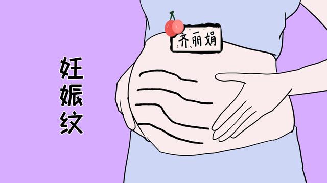 孕期会不会长妊娠纹，除了这2点，遗传方面也要关注