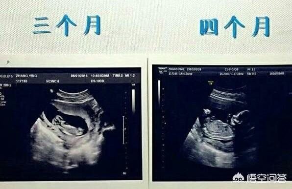 小宝宝在妈妈肚里几个月胎动算正常？