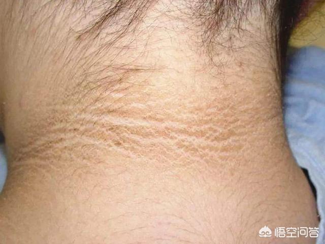 宝宝为什么会越来越黑？