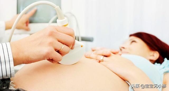 怀孕37周后，胎动出现这个变化是好事，孕妇别紧张