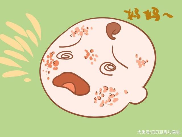 宝宝湿疹长得满脸都是？学会这几步，还宝宝健康肌肤！