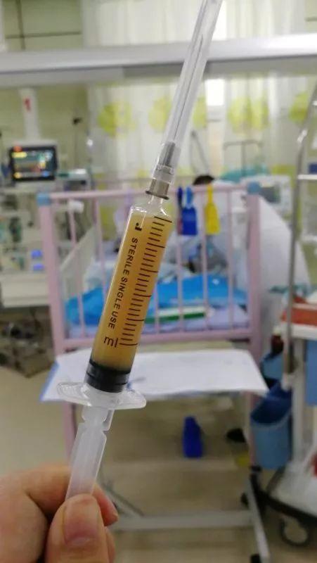 6个月女婴咳嗽15天后夭折！送院时已全身溃烂！孩子出现这些症状，家长千万小心！