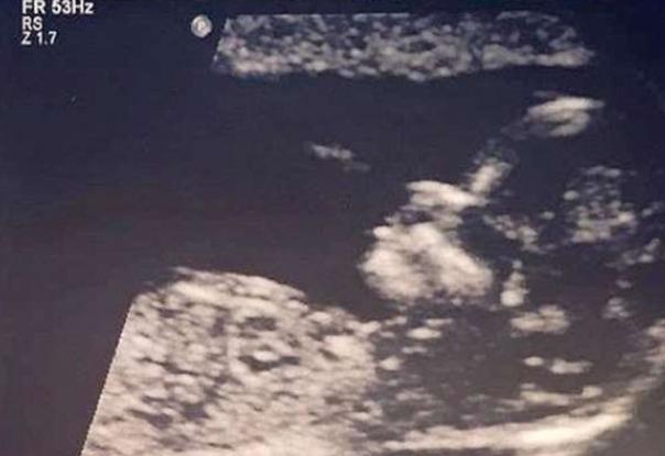 6个月小女孩打从娘胎内就长出一头秀发，这才是真的赢在起跑线上