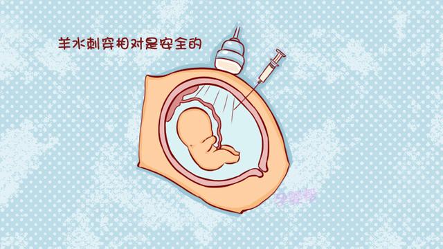 做完羊水穿刺后，孕妈要牢记这3件事，不然相当于白做了
