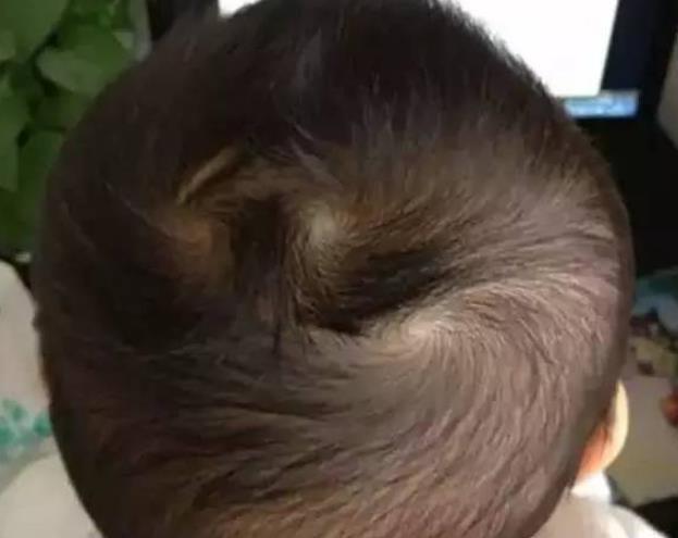 孩子头上几个旋，是否和孩子的性格有关？看完后你就知道了！