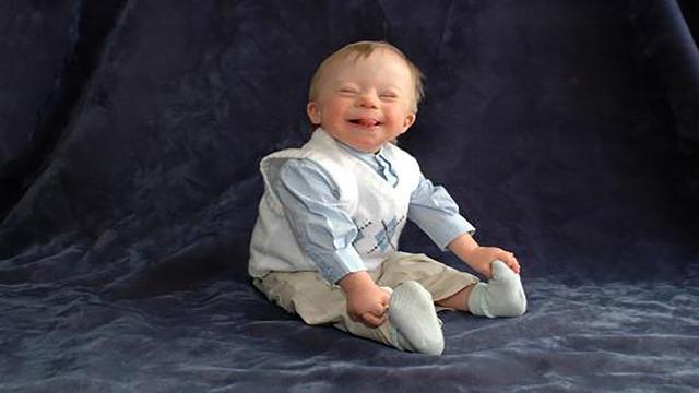 这三种孕妈有可能生出“痴呆宝宝”，尤其是其二，孕妈们要留意哦