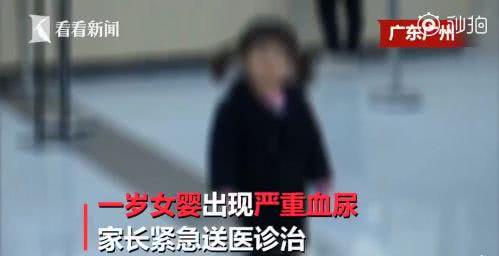 很多孩子有这样的错误饮食习惯，1岁女婴双肾长满结石