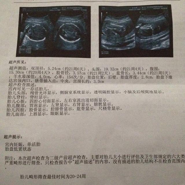 孕期产检重头戏：大排畸！胎儿发育如何、有无畸形，教你全部看清