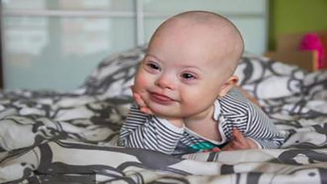 这三种孕妈有可能生出“痴呆宝宝”，尤其是其二，孕妈们要留意哦