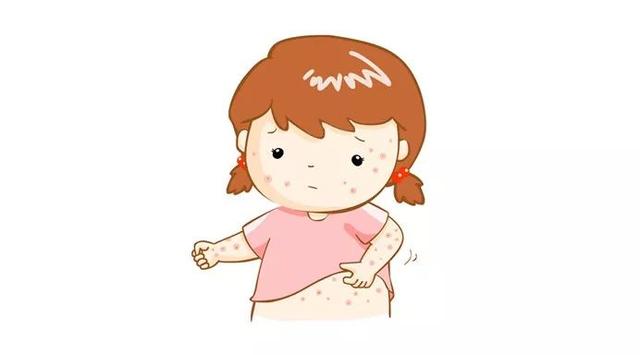 不干不红不湿疹，冬季宝宝护肤这么做！