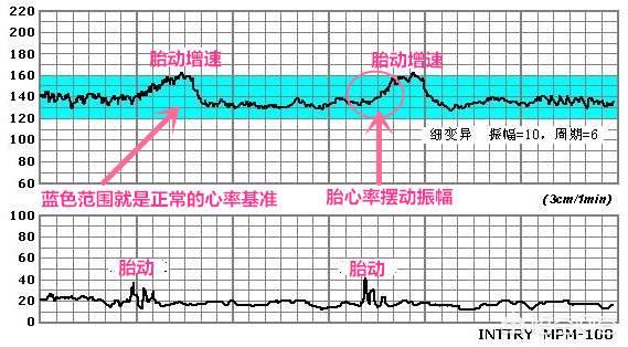 为什么在家自己数胎动一个小时三到五次正常，而在医院做胎监二十分钟就要动三次以上呢？