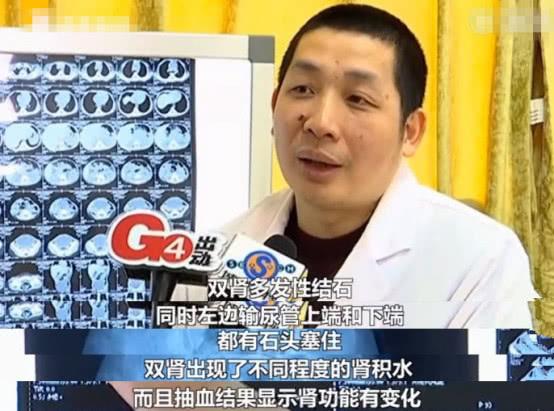 因为父母担心孩子身高输在起跑线疯狂补钙，1岁女婴双肾长满结石
