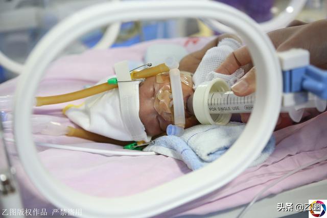 宝宝早产仅1.34公斤重，妈妈流泪剃满头秀发祈祷：好想早日抱抱你