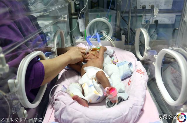 宝宝早产仅1.34公斤重，妈妈流泪剃满头秀发祈祷：好想早日抱抱你