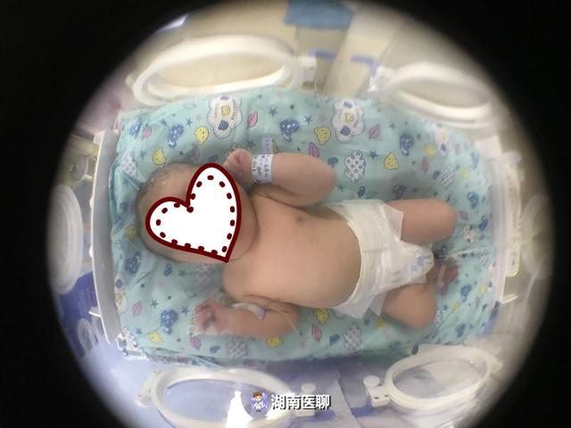 父母擅自喂药致病情加重！“茵栀黄口服液”绝不是治疗黄疸万能药