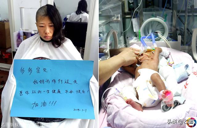 宝宝早产仅1.34公斤重，妈妈流泪剃满头秀发祈祷：好想早日抱抱你