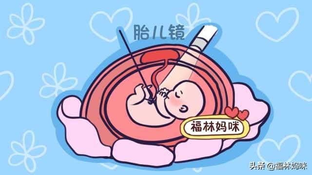 孕期这三项检查孕妈很受罪，准爸爸工作再忙，也要抽出时间陪孕妈