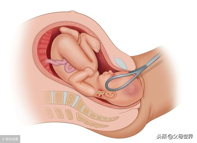 脐带绕颈胎宝会不会感觉痛苦？还能顺产吗？10点专家为你一一解答