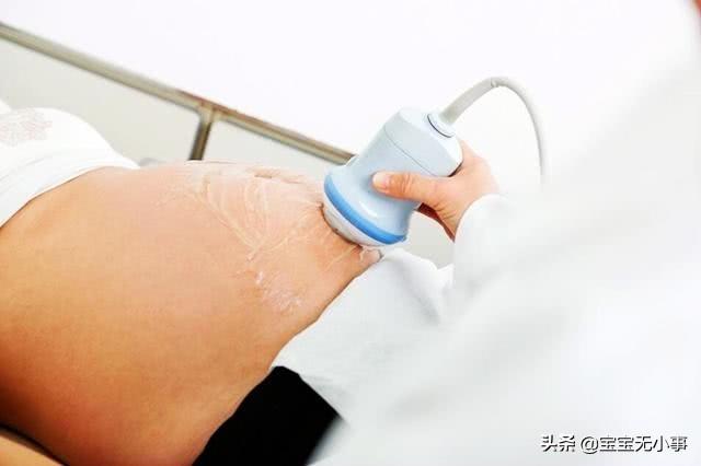 孕妇有这4个症状，别忽视，可能是胎儿缺氧的信号