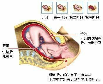 怀孕39周还不入盆怎么办，可以顺产吗？