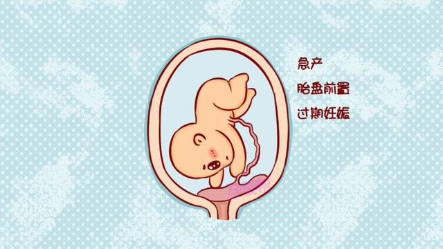 这6类孕妈，需要提前住院待产，别还傻傻等预产期