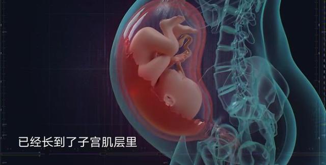 25岁姑娘赌命生子：女人，拿命生孩子，不值得！