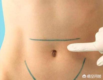 都是剖宫产，为什么有人伤口是横的，也有人是竖的呢？