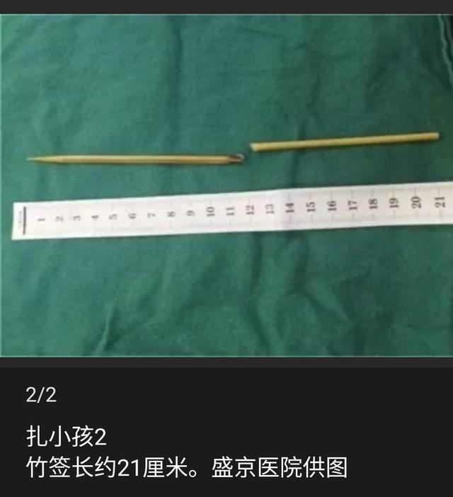 类似事件不止1例！小儿外科、急诊科联合警示：远离小儿意外伤！