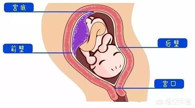 胎盘后壁和前壁有什么区别？