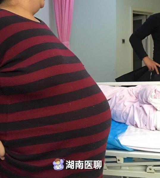孕妇重达249斤！二孩妈妈孕期过度进补，患上高血压、糖尿病