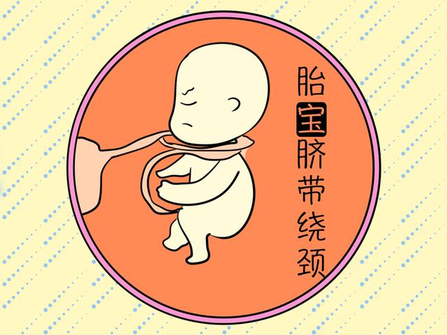 孕期这几件事，会增加胎宝宝脐带绕颈的几率，最好别有！