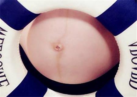 孕产知识：妊娠中线都是黑色吗？神秘的“孕黑线”你了解多少？