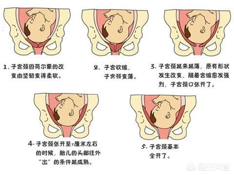 为什么有的孕妇不开骨缝？
