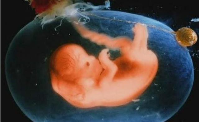 你觉得未出生的胎儿，会做梦吗？有何依据？听听专家怎么说