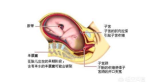 为什么有的孕妇不开骨缝？