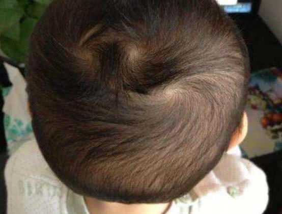 孩子头上有几个“旋”，和孩子“性格”有关么？看完你就知道了！