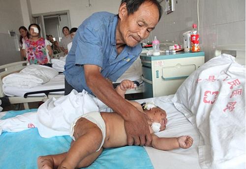哺乳时宝宝总是咬妈妈，不敢打也不敢扯，这4招教你缓解疼痛