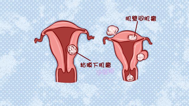中国约有三分之一女性,都患过这种疾病,对胚胎发育有很大影响