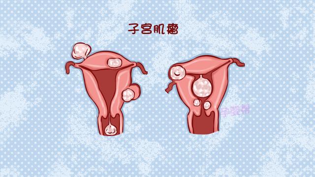 中国约有三分之一女性,都患过这种疾病,对胚胎发育有很大影响