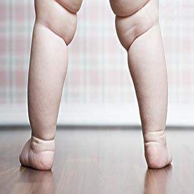 合肥百个学龄前儿童有6个肥胖，且呈逐年上升态势，你怎么看？