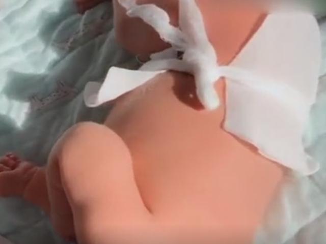 新生儿患黄疸晒太阳，这情景真的让人心疼，网友称妈妈的心更疼