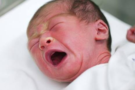 新生儿出现这些异常现象，其实都是正常的，新手爸妈不用担心