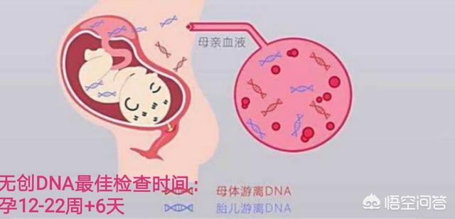 做无创dna检测的最佳时间是怀孕几个月的时候呢？