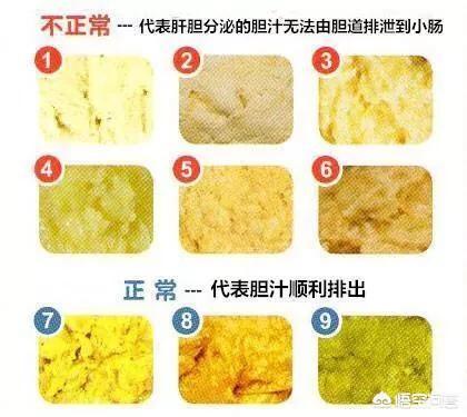 四个月大的宝宝纯母乳喂养，最近总是早上排黄色粪便而白天排绿色粪便，这是怎么回事儿？